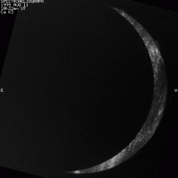 Eclipses du Soleil